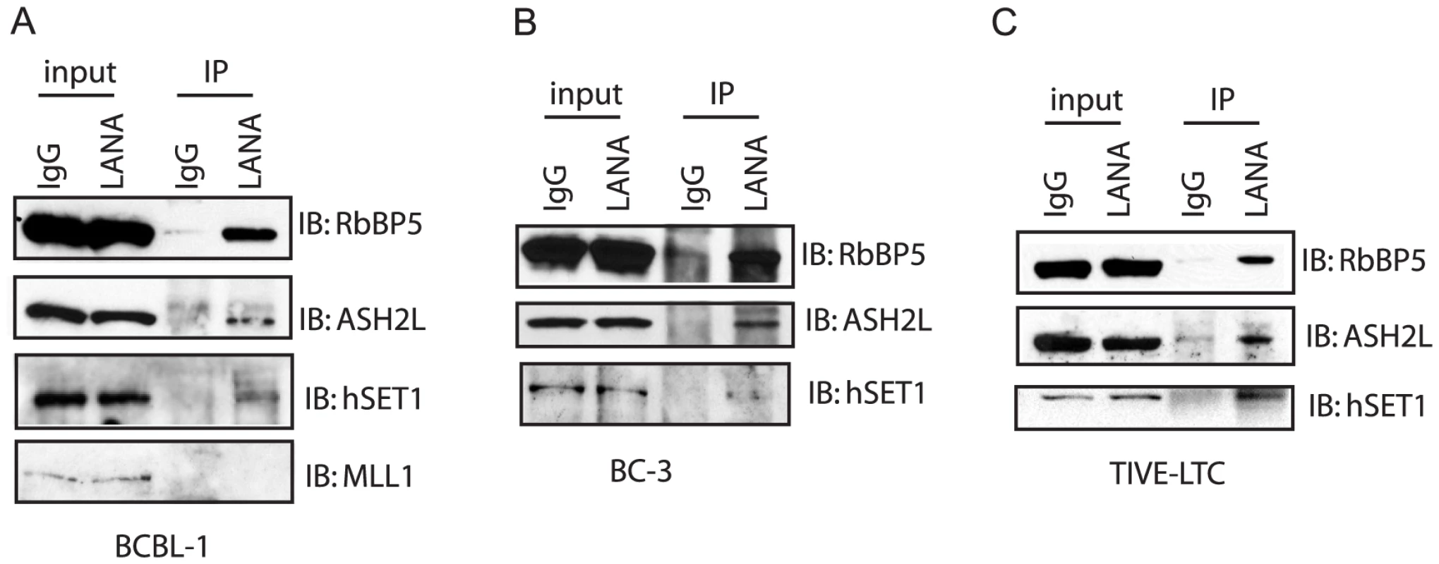 LANA forms complex with H3K4me3 methyltransferase hSET1 <i>in vivo</i>.