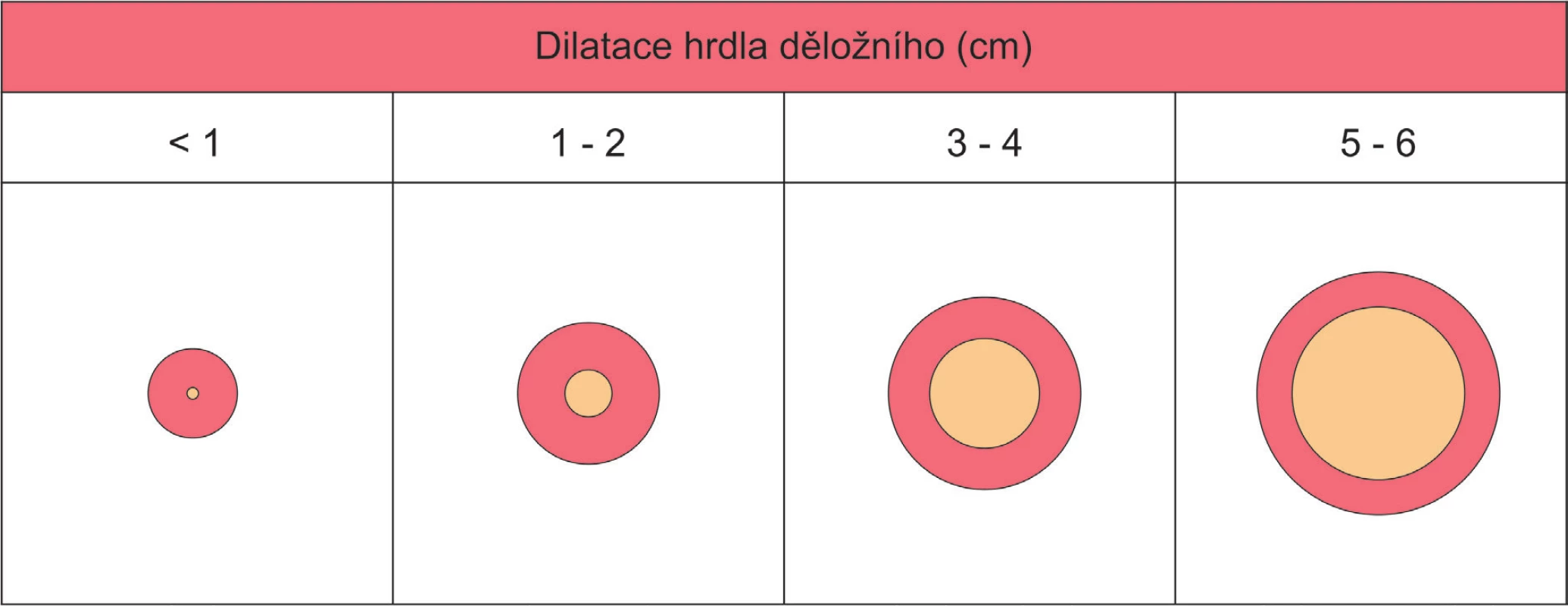 Hodnocení DILATACE hrdla děložního