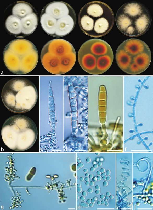 Morfologie <i>Trichophyton interdigitale</i> v současném pojetí