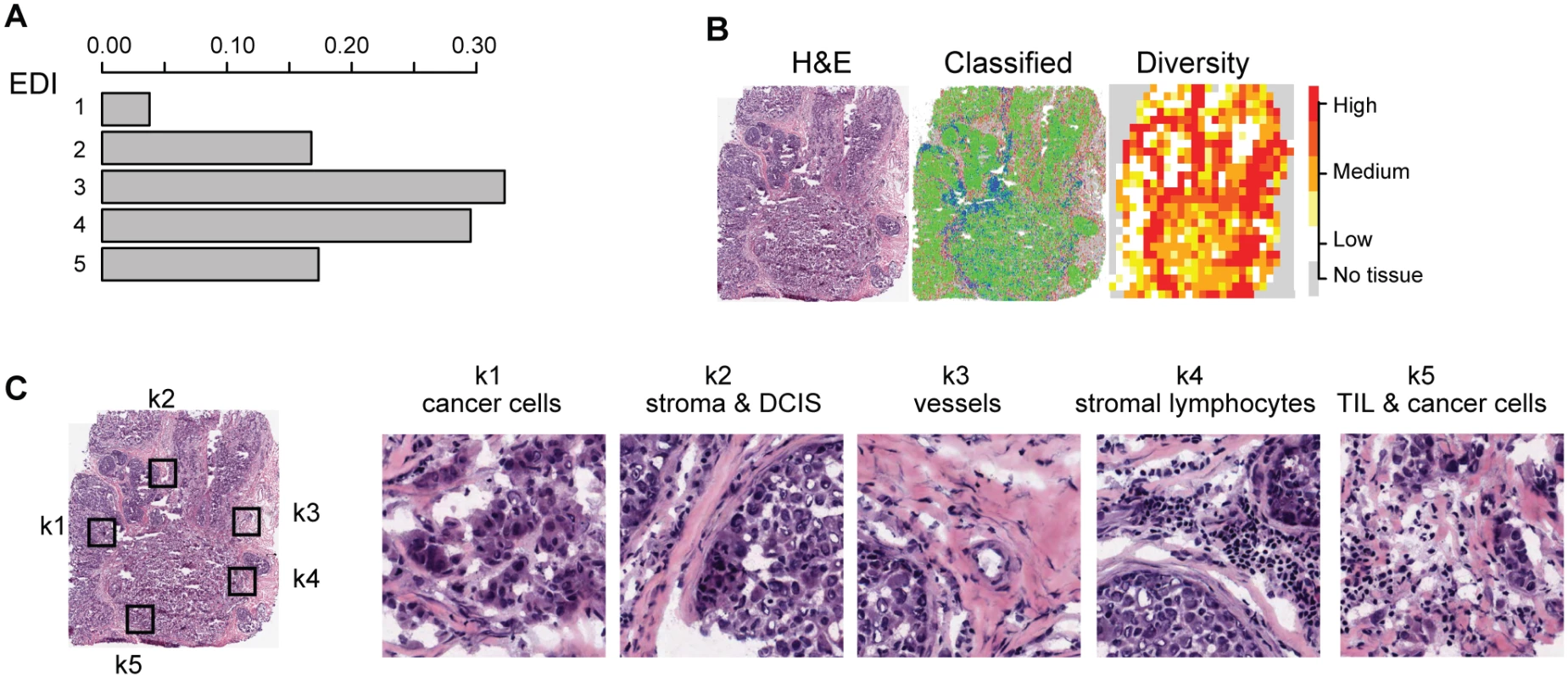 Application of EDI to 1,026 breast tumors from the METABRIC study.