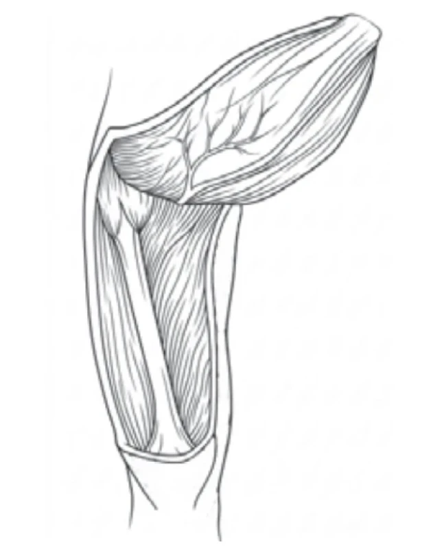  / Fig. 4.