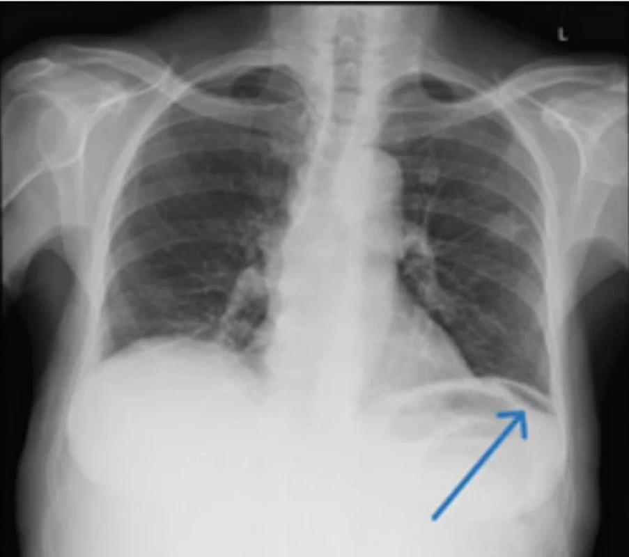  / Fig. 2.