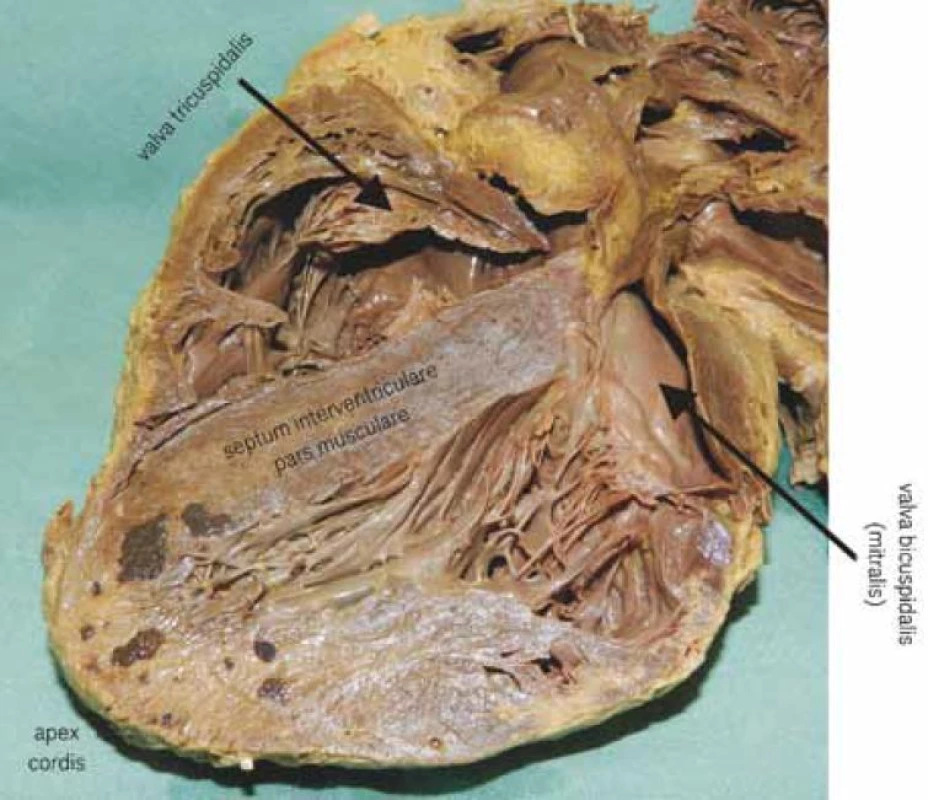 Anatomické poměry (foto archiv autora).