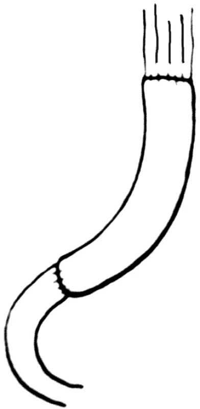 Rekonstrukce podle Longmire
Fig. 2. Longmire reconstruction