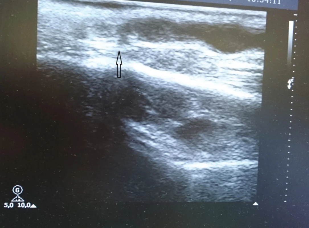 Totéž
Fig. 7: The same as above