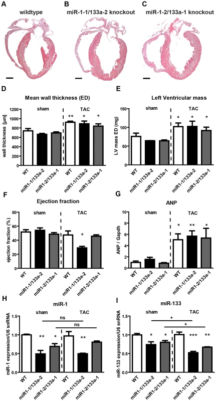 Deletion of single <i>miR-1/133a</i> clusters does not cause gross morphological alterations in the heart but results in decreased ejection fraction in <i>miR-1-1/133a-2</i> mutants after TAC.