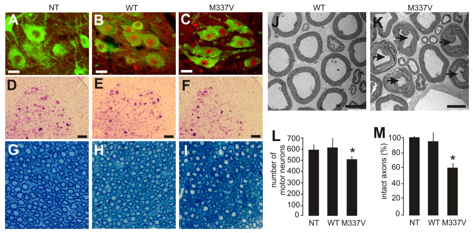 Neuronal death and axonal damage in transgenic rats expressing a mutant human <i>TDP</i> gene.