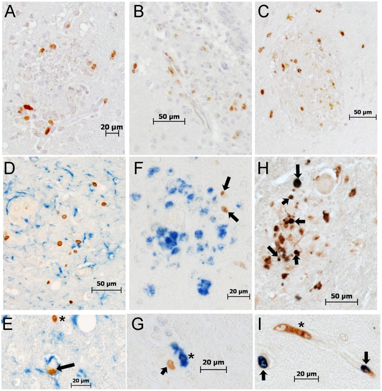 Histopathologic studies showed evidence of BrdU+ cells, the majority of which are Mac387+, in the brains of macaques with SIVE.