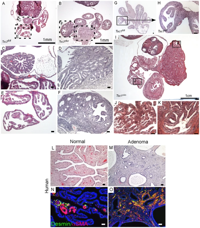 Conditional deletion of <i>Tsc1</i> or <i>Tsc2</i> phenocopies some of the changes observed in <i>LKB1<sup>cko</sup></i> oviducts.