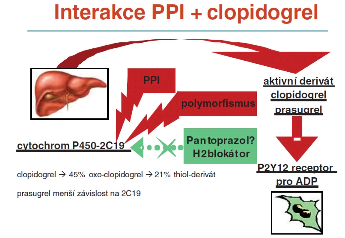 Interakce gastroprotektiv a antiagregace – vliv PPI na účinnost clopidogrelu