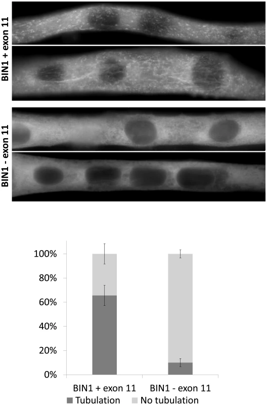 Essential role of <i>BIN1</i> exon 11 in membrane tubulation in myotubes.