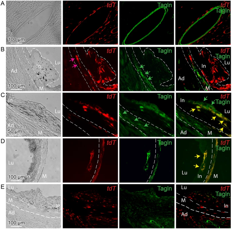 <i>Tcf21</i> expressing cells in <i>ApoE</i><sup><i>-/-</i></sup> lesions give rise to smooth muscle cells in the fibrous cap.