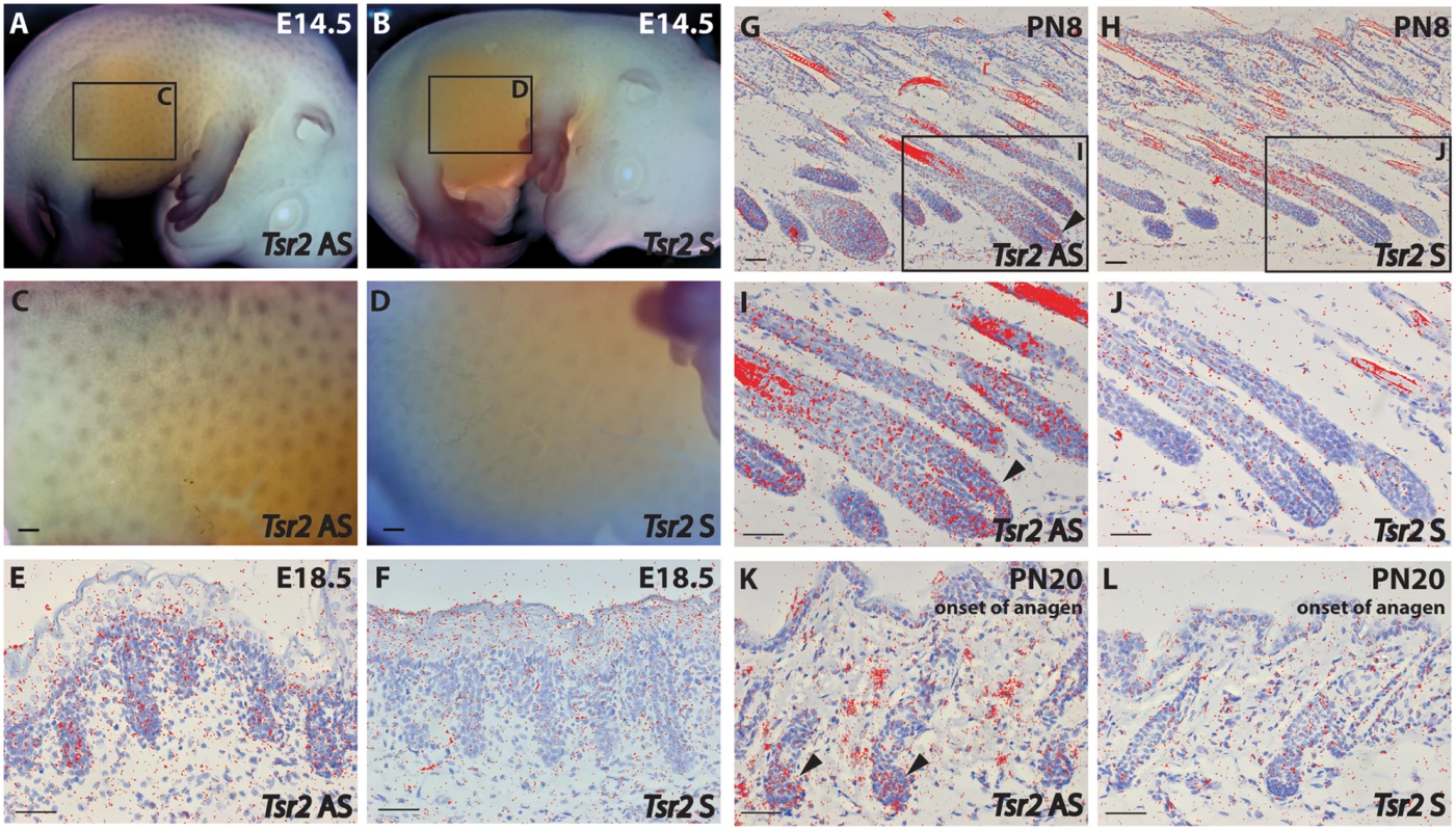 <i>Tsr2</i> is expressed in murine hair follicles.