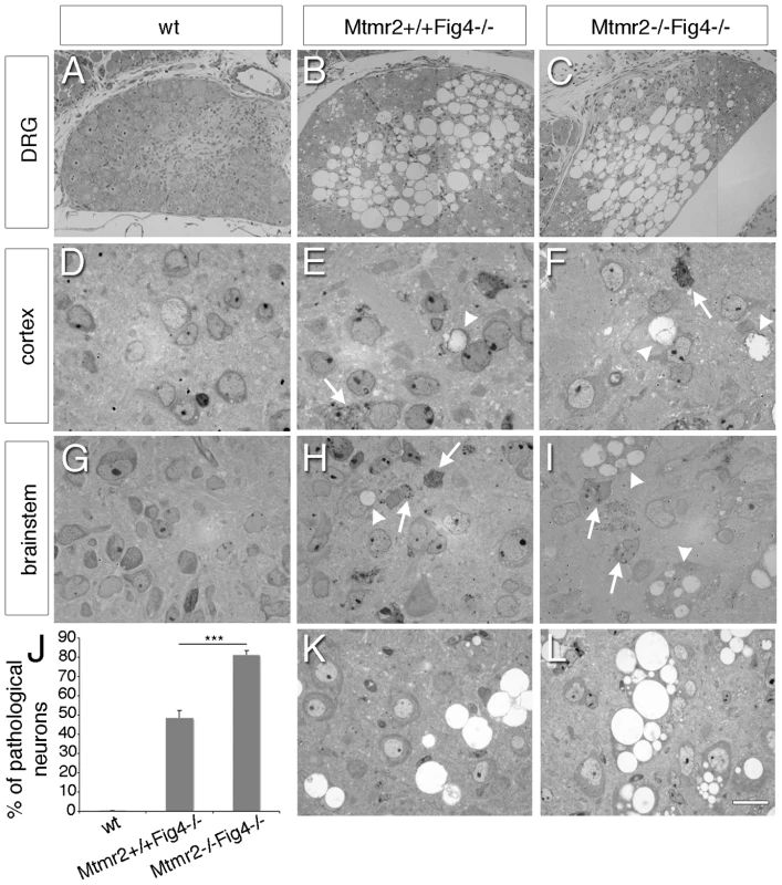 Neurodegeneration in <i>Mtmr2</i>+/+<i>Fig4</i>−/− and <i>Mtmr2</i>−/−<i>Fig4</i>−/− mice.