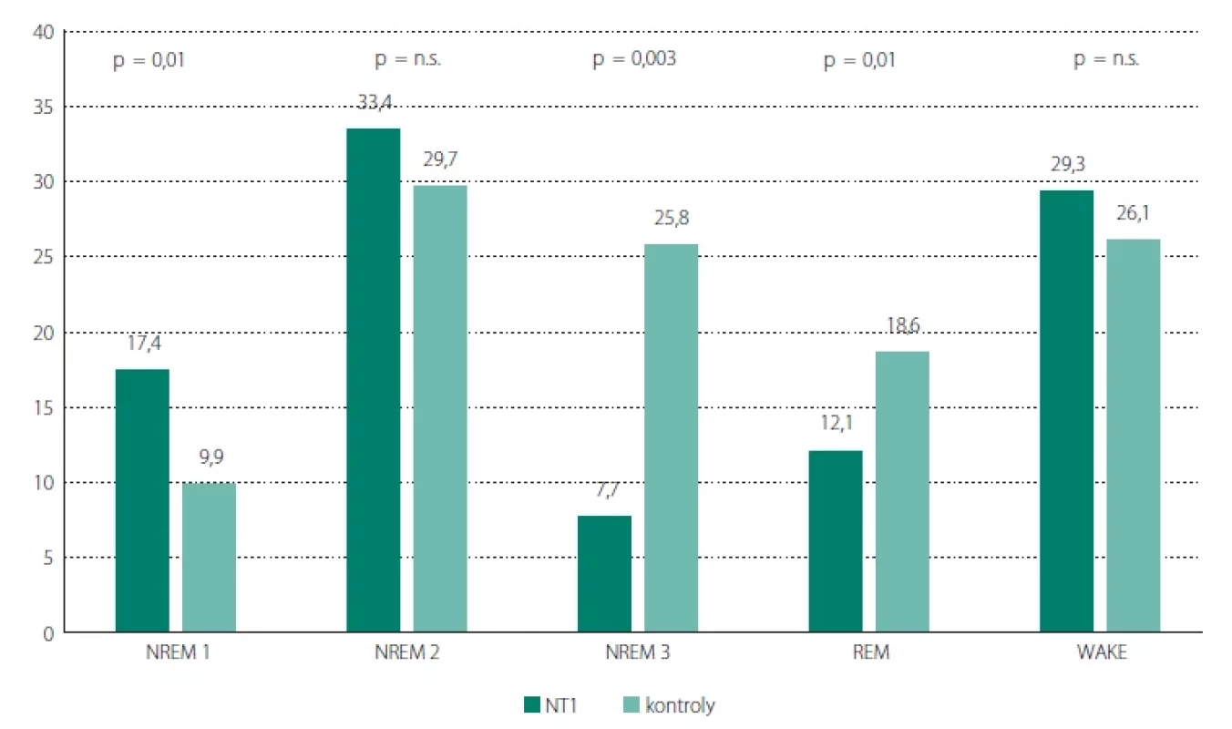 Procentuální zastoupení spánkových stadií a bdělosti během spánku.</br>Fig. 1. Percentage representation of sleep stages and wakefulness during sleep.