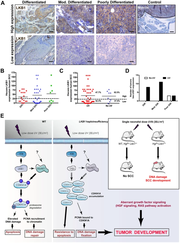 LKB1 expression in human skin-SCC.