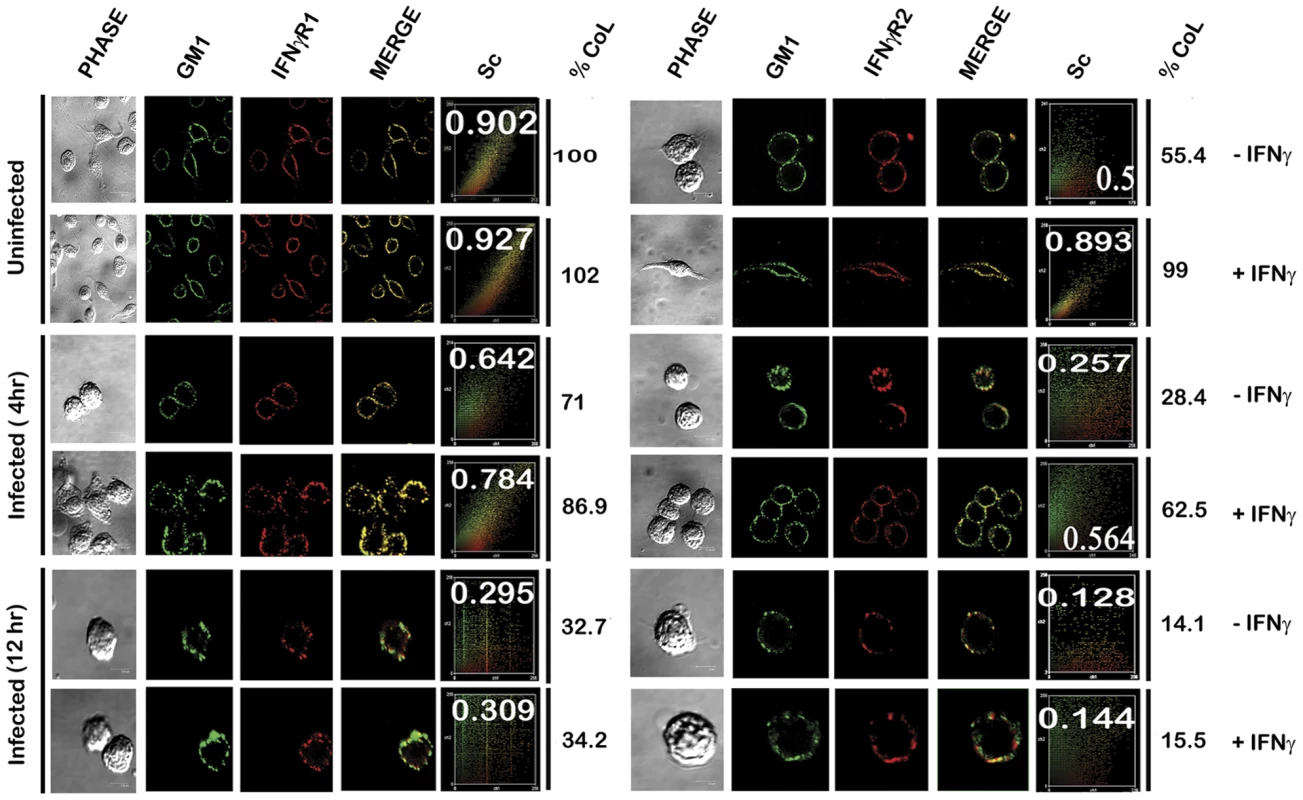 Confocal colocalization analysis of the IFNγR subunits in uninfected and LD infected macrophages.