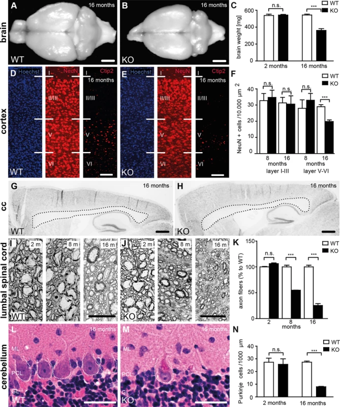 Loss of Spatacsin causes severe neuron loss in the motor cortex and the cerebellum.