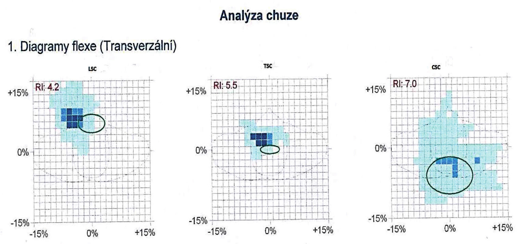 Diagram flexie – chôdza s kočíkom.
