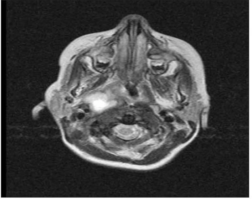 MRI před výkonem.