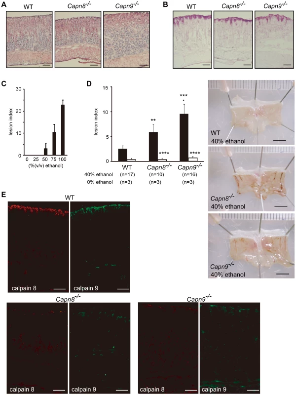 <i>Capn8</i> or <i>Capn9</i> deficiency increased the susceptibility to ethanol-induced gastric lesions.