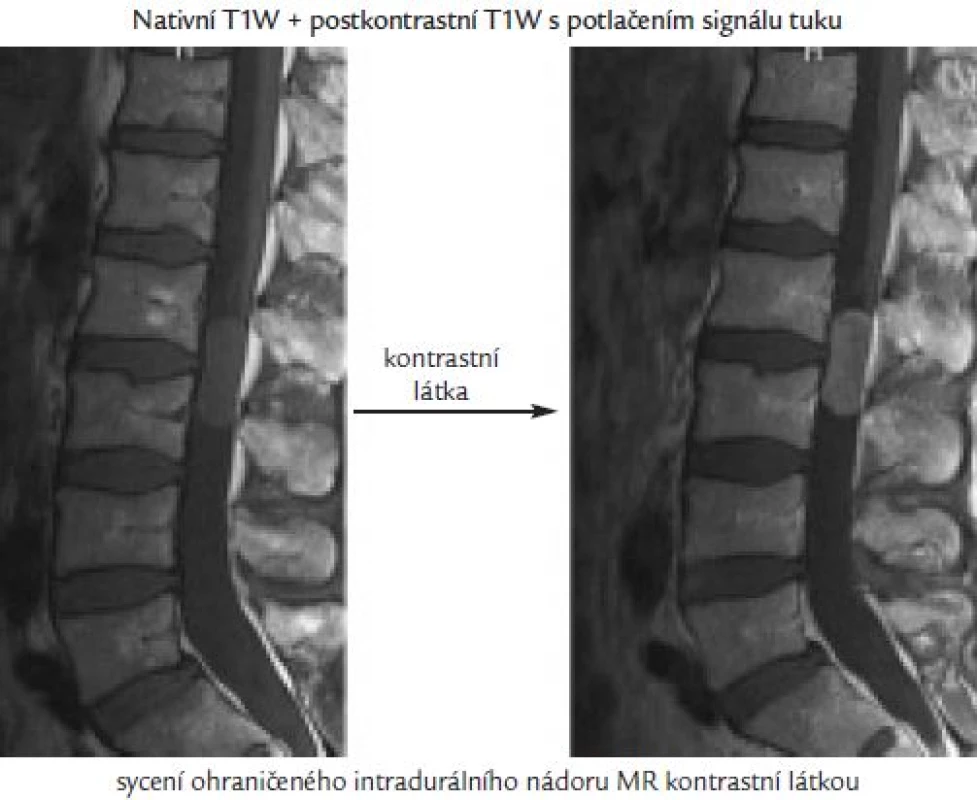 Opět diferenciální diagnostika bolestí páteře.