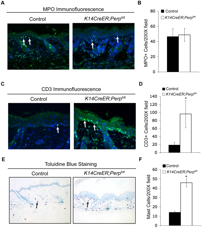 Combined Perp-deficiency and chronic UVB exposure induce immune cell infiltration in the skin.