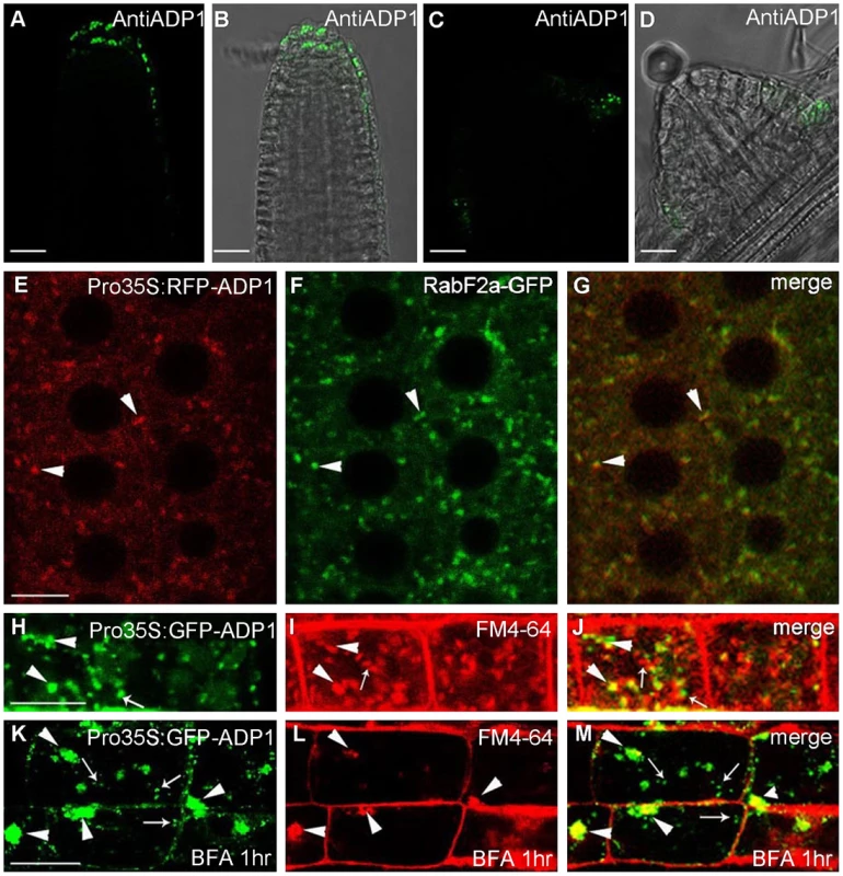 Subcellular localization of <i>ADP1</i>.
