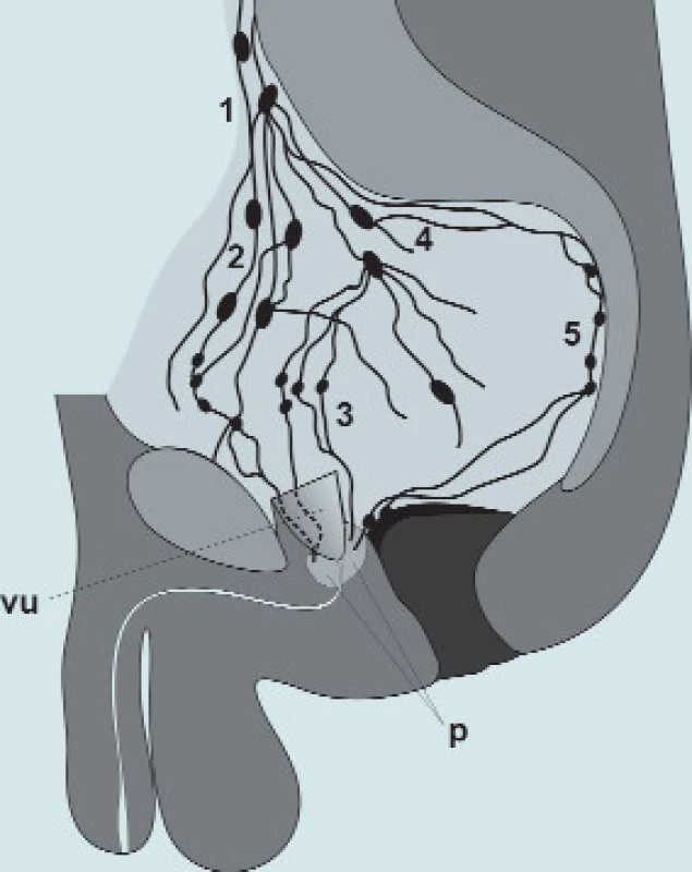 Lymfatické uzliny pánve:
1 - nodi lymphatici iliaci communes
2 - nodi lymphatici iliaci externi
3 - nodi lymphatici obturatorii
4 - nodi lymphatici iliaci interni
5 - nodi lymphatici sacrales
p - prostata
vu - vesica urinaria