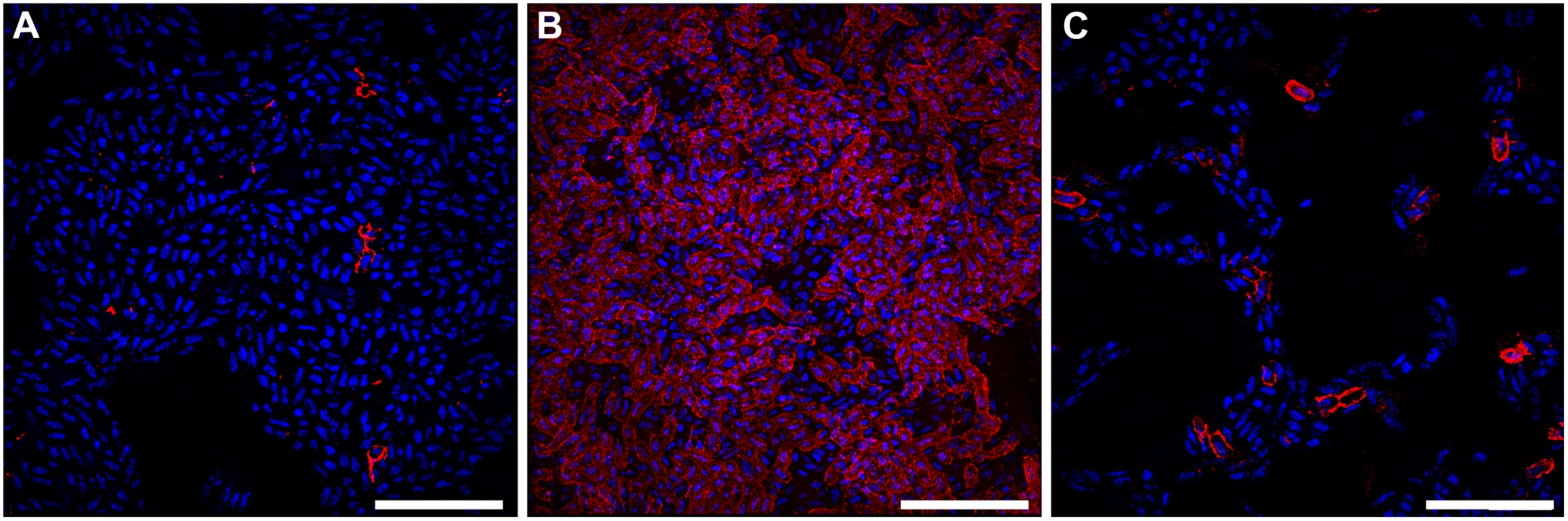 Bacteria expressing curli amyloid fibers localize primarily to the air-liquid interface of a 48-hour surface-associated biofilm.