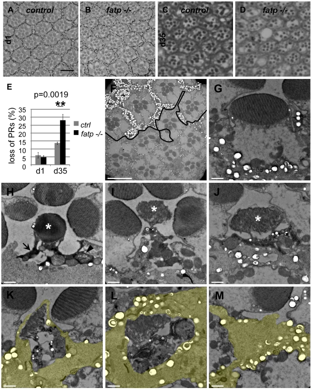 Histological analysis of <i>fatp<sup>−/−</sup></i> PR degeneration.