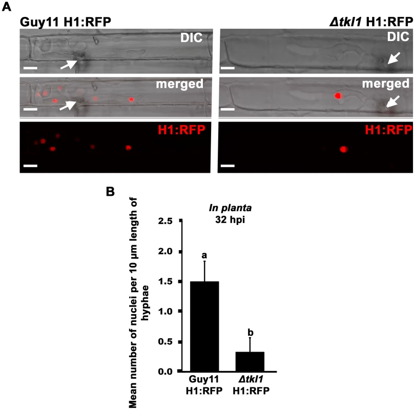 Nuclear division is attenuated in Δ<i>tkl1</i> mutant strains <i>in planta</i>.