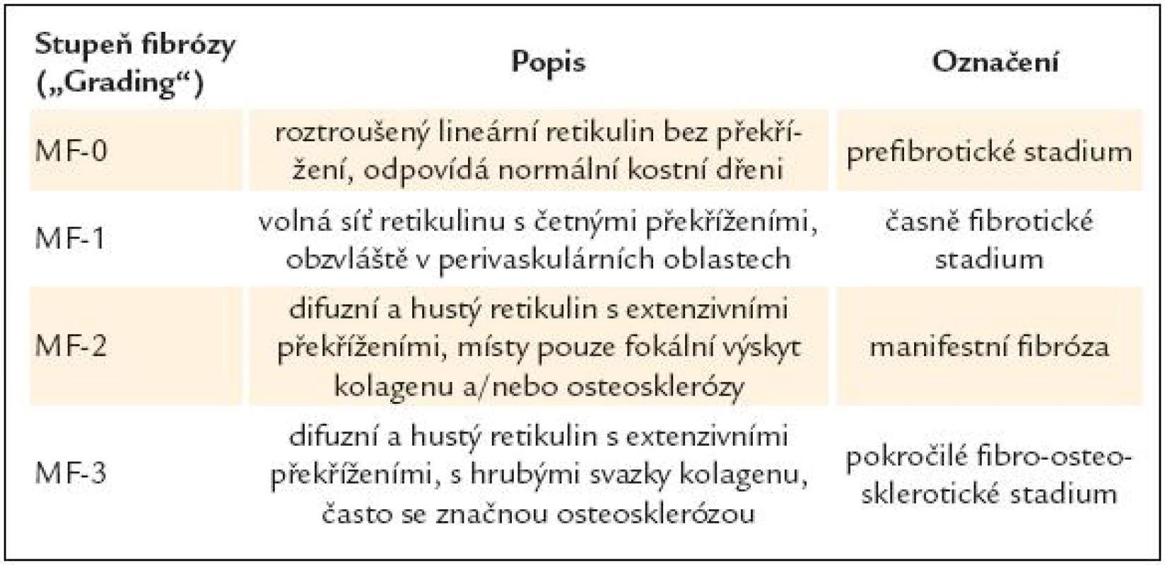 Stupně fibrózy kostní dřeně podle tzv. evropských konsenzus kritérií [35].