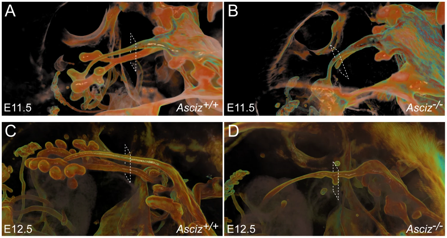 Defective pulmonary and tracheal development in <i>Asciz</i>-null embryos.