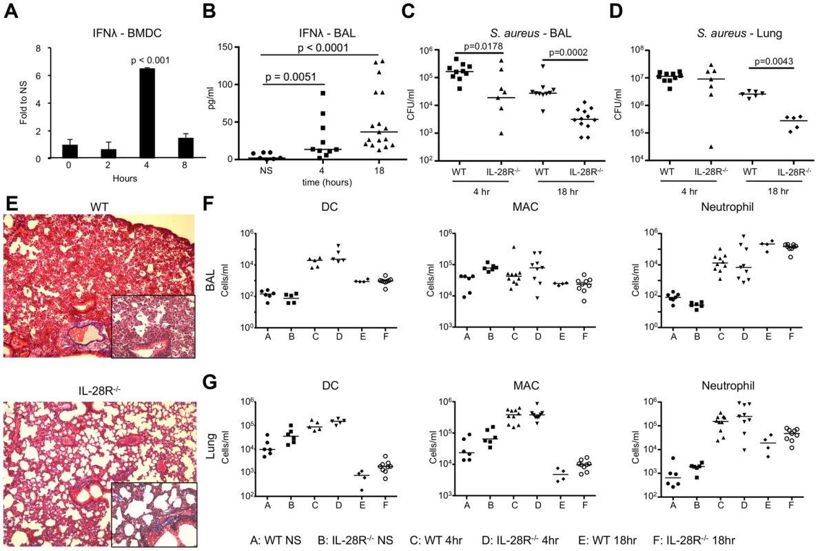 Induction of IFNλ by <i>S. aureus</i> USA300 inhibits bacterial clearance.