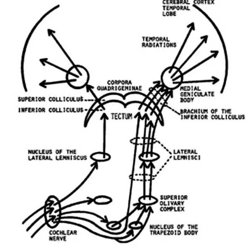 Cochlear nerve n. cochlearis
Nucleus of the trapezoid body nc. corporis trapesoidei
Superior olivary oliva superior
Lateral lemnisci lemniscus lateralis
Nuc of the lateral lemniscus nc. lemnisci lateralis 
Tectum tectum
Inferior collicul coliculus inferior
Brachium inf coll brachium coliculi inf.
Superior coll coliculus superior
Corpora quadrigemina čtverohrbolí
Medial geniculate corpus geniculatum mediale
Temporal radiation spánková radiace
Temporal lobe spánkový lalok