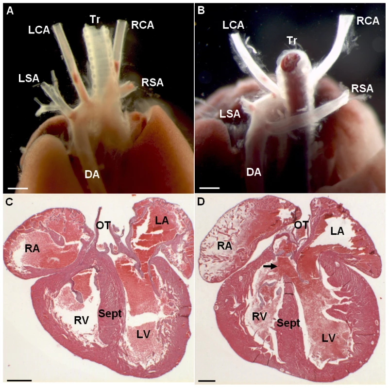 Changes in cardiovascular morphology observed in the Ts65Dn model.