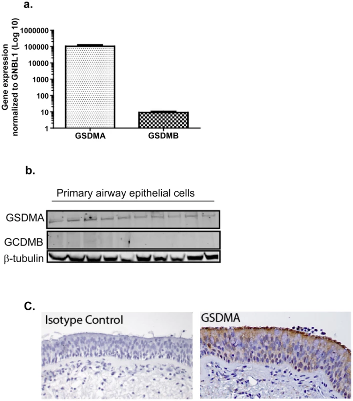 Relative expression of <i>GSDMA</i> and <i>GSDMB</i>.