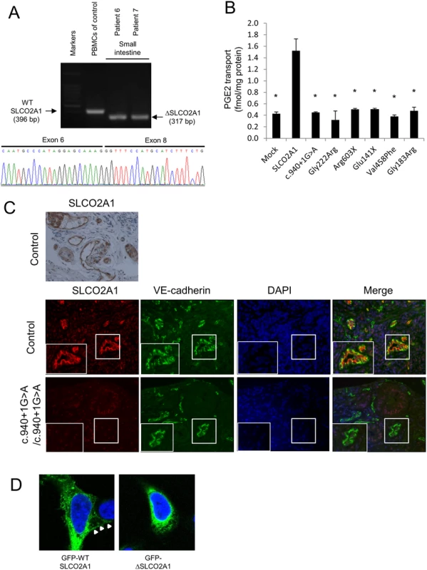 Genetic and functional analyses of <i>SLCO2A1</i> gene mutations.