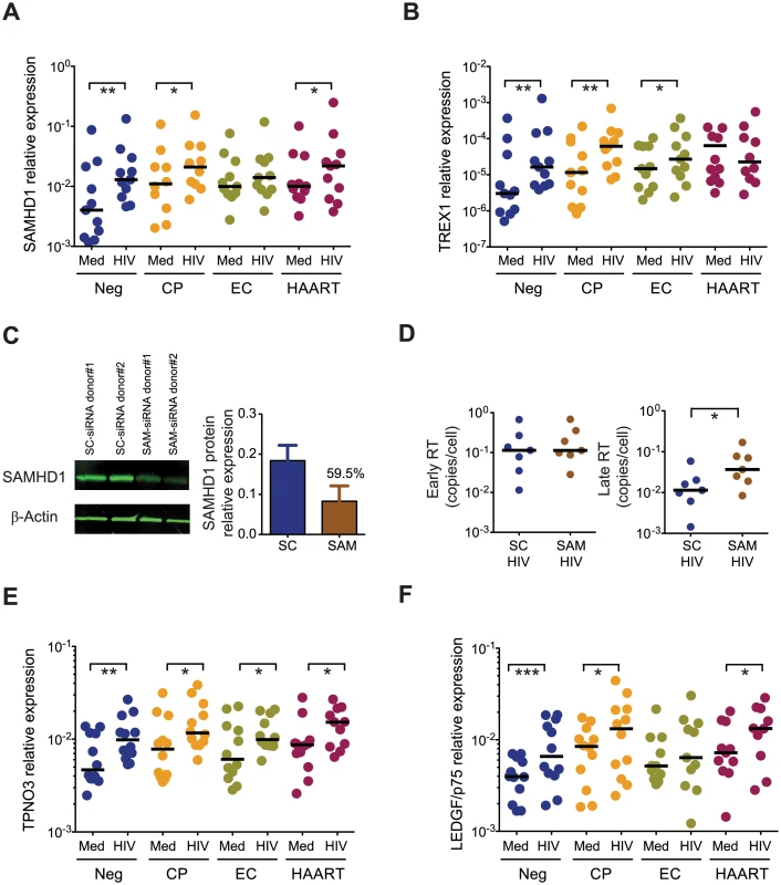 Expression of host restriction factors in cDCs from EC.