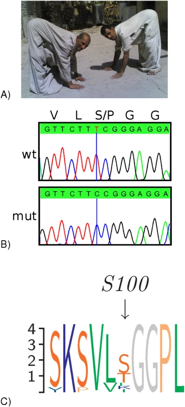 <i>CA8</i> Mutations in two families with ataxia and mild mental retardation.