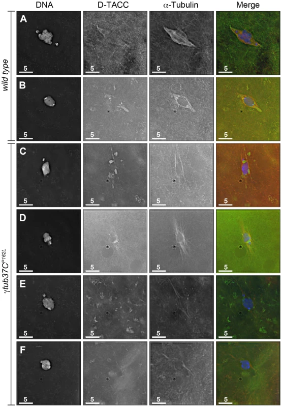 The spindle pole component D-TACC is mislocalized in <i>γtub37C<sup>P162L</sup></i> mutant oocytes.