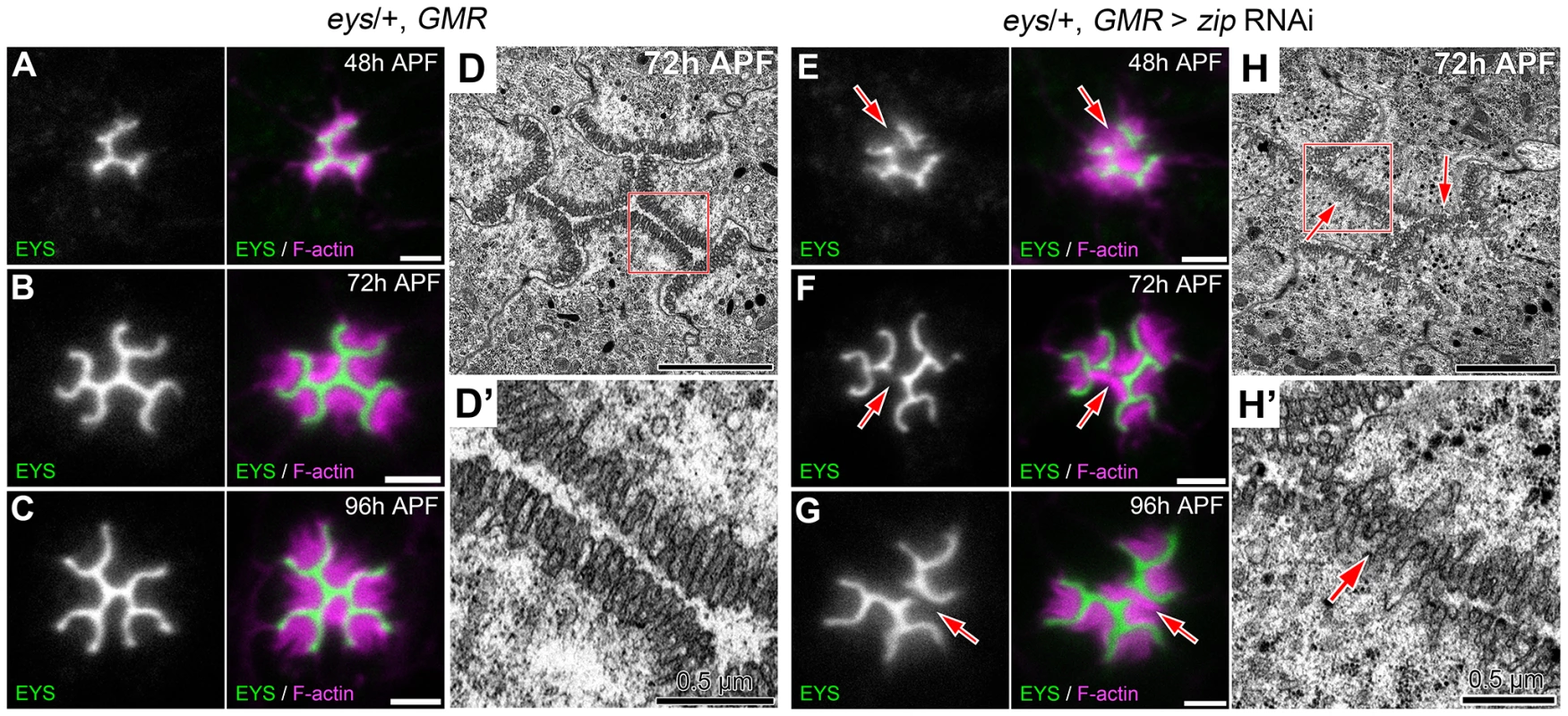 Defects in apical membrane separation are detected early and maintained throughout development.