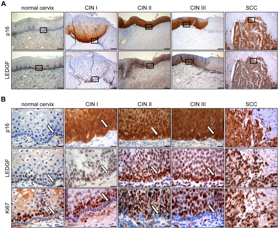 Immunohistochemical analysis of LEDGF expression.