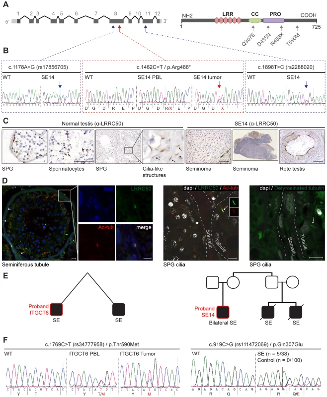 Genetic analysis of <i>LRRC50</i> in human seminoma samples.