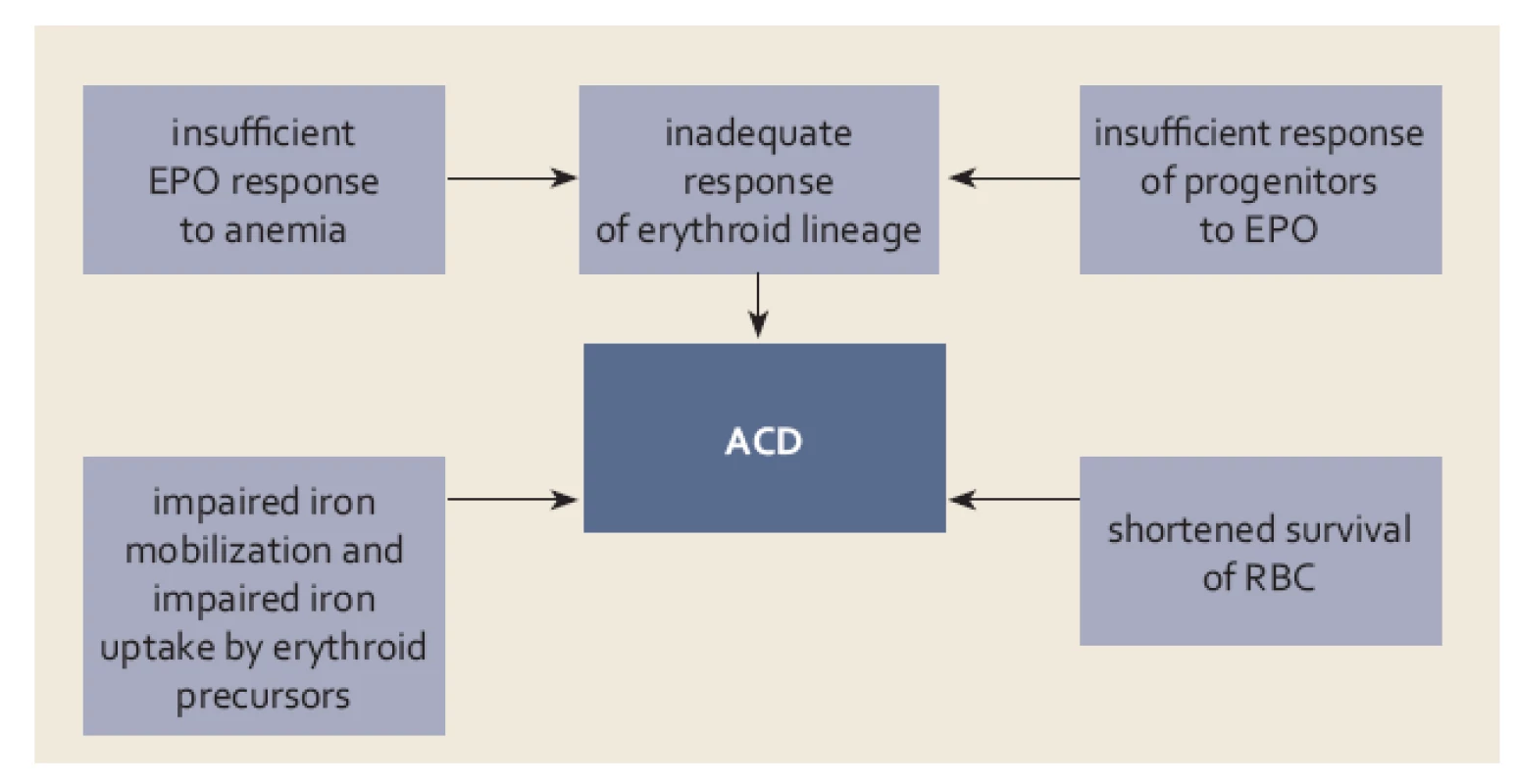 Základní mechanizmy uplatňující se v patogenezi anémie při chronickém onemocnění (ACD) (bližší vysvětlení v textu).
Fig. 4. Basic mechanisms involved in the pathogenesis of anaemia in chronic dis ease (ACD) (detailed explanation in the text).