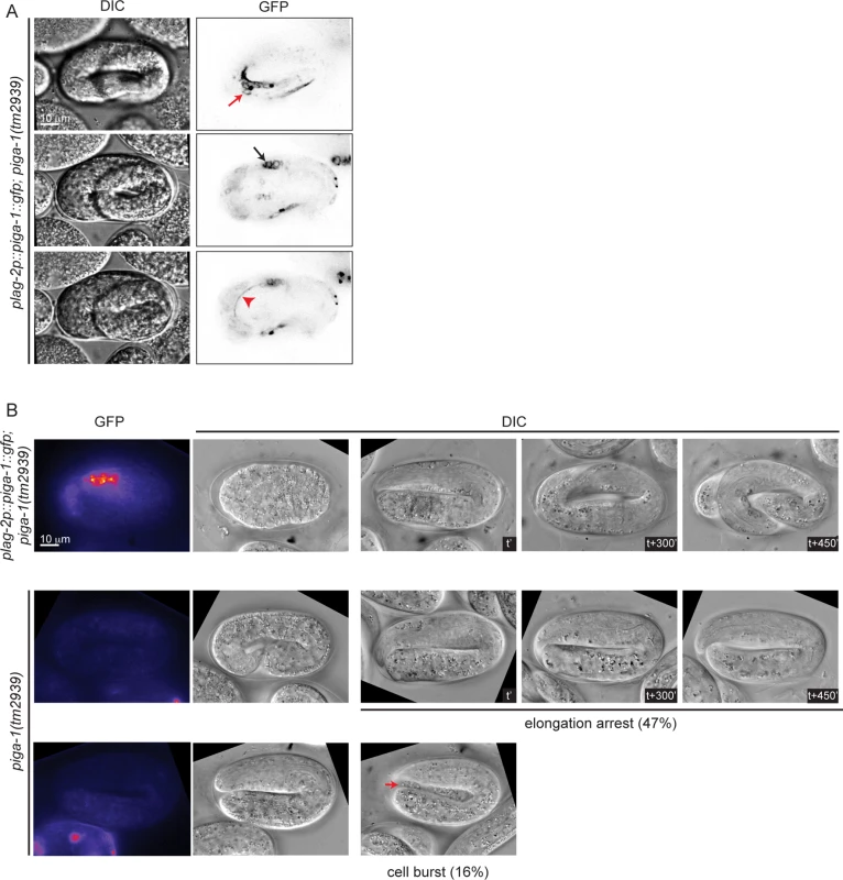 Loss of function of <i>piga-1</i> shows similar phenotypes to <i>pigv-1(qm34)</i> mutant embryos.