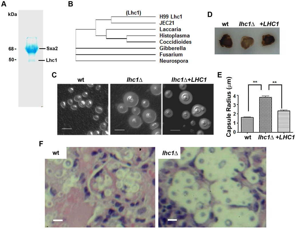 Identification of a capsular-adherent putative lactonohydrolase from <i>C. neoformans</i> and role in virulence-related phenotypes.