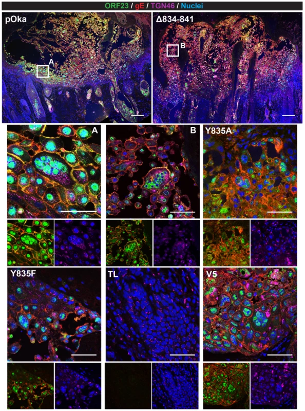 Pathogenesis of VZV with mutations in the gHcyt in human skin xenografts.