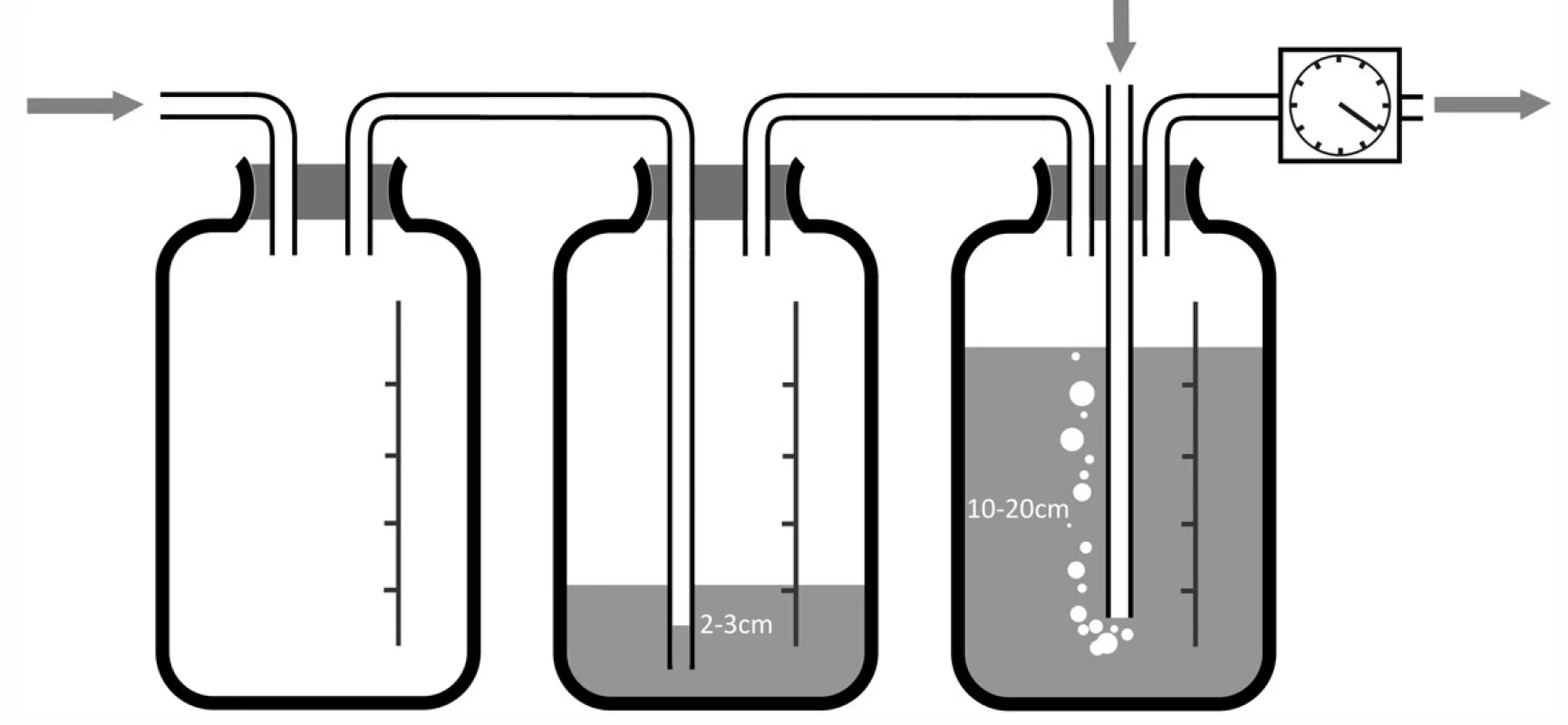 Vícelahvový systém pro hrudní sání a) dvoulahvový systém; b) třílahvový systém.
Fig. 5: Multi-bottle system for chest suction a) two-bottle system ;b) three-bottle system.